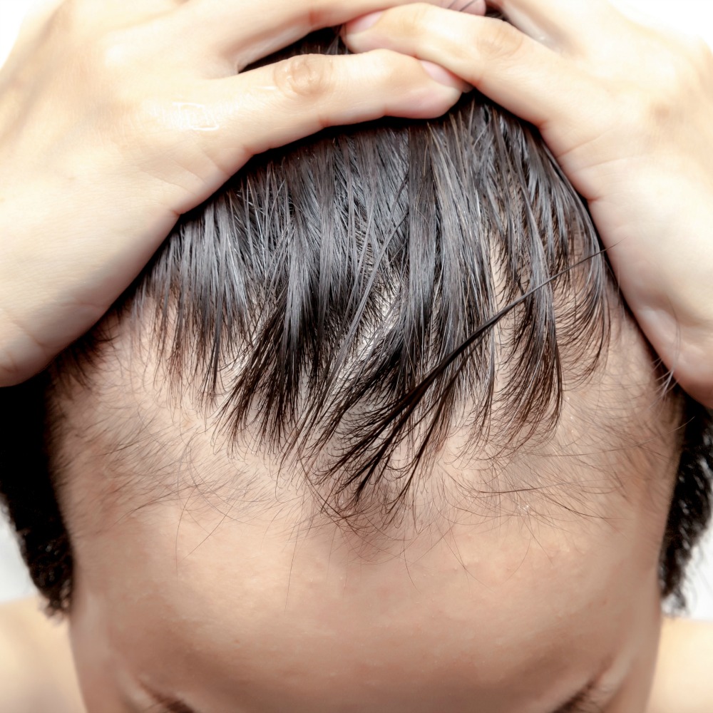 Experimental Drug Reverses Skin Damage And Hair Loss