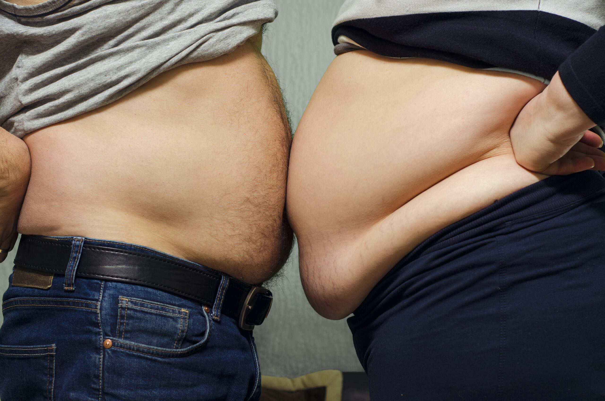 Close To Half Of American Adults Projected To Be Obese By 2030