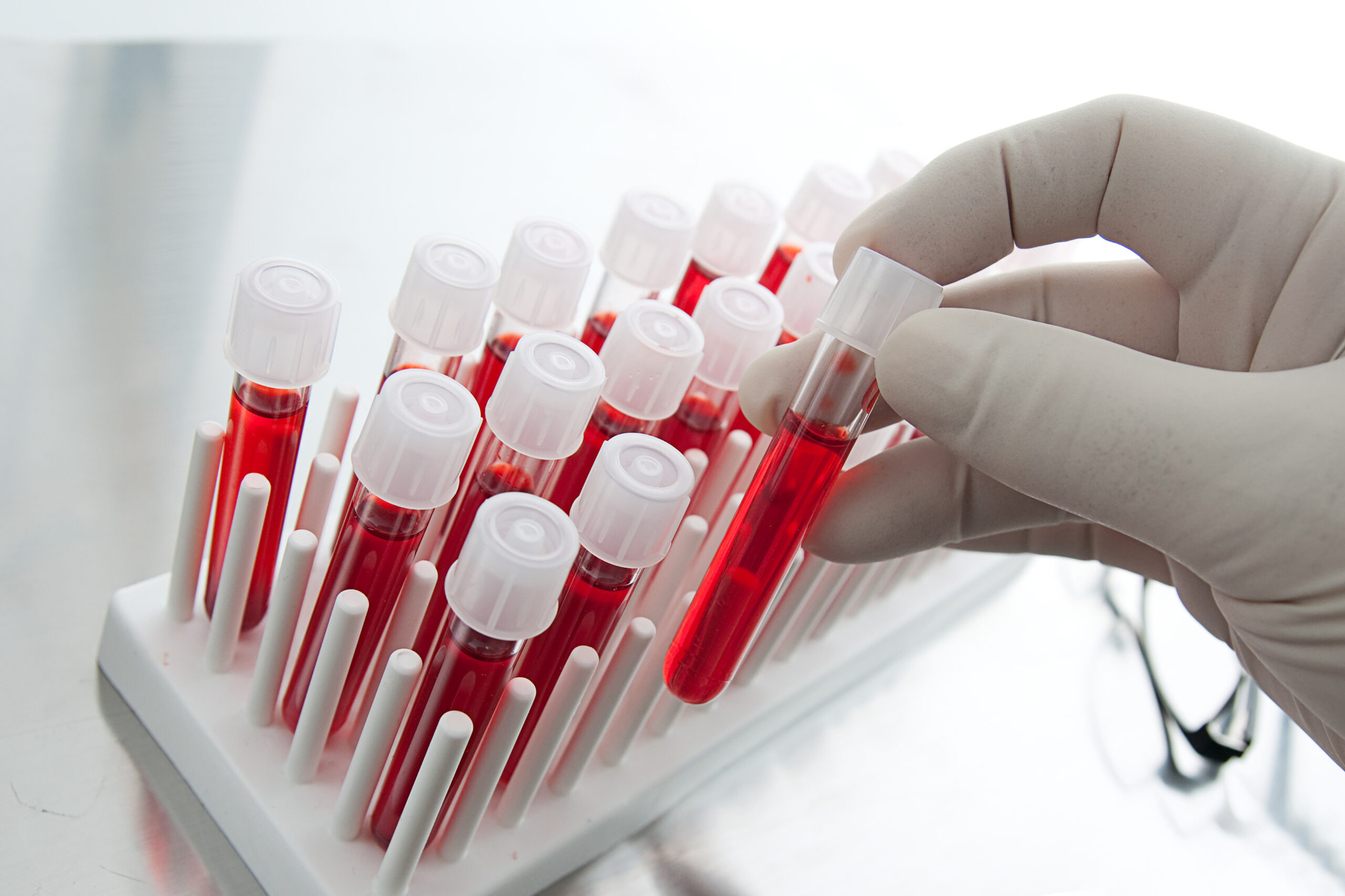 Cancer “Liquid Biopsy” Blood Test Gets Expanded FDA Approval