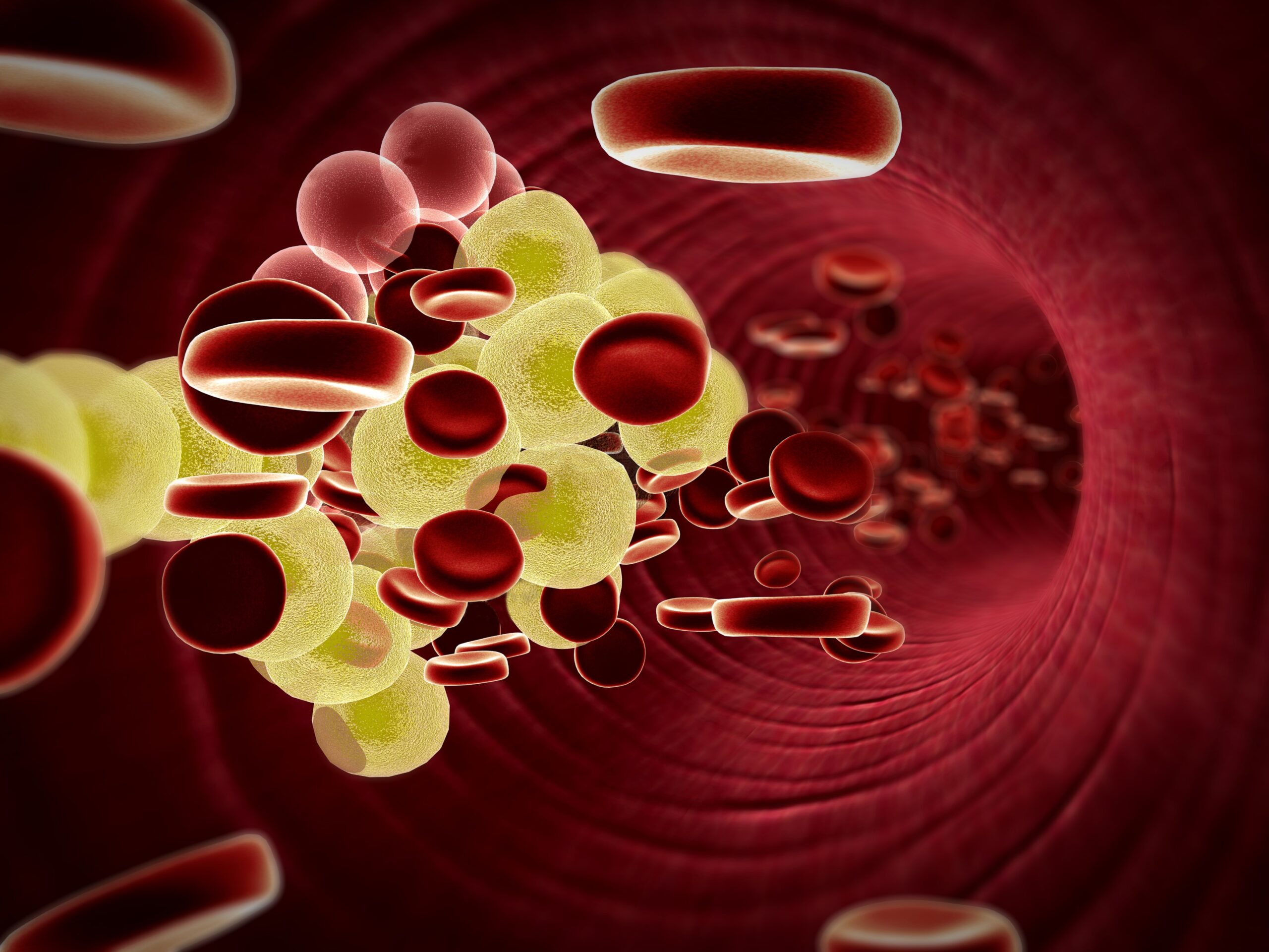 Protein that blocks the body's ability to clear bad cholesterol identified