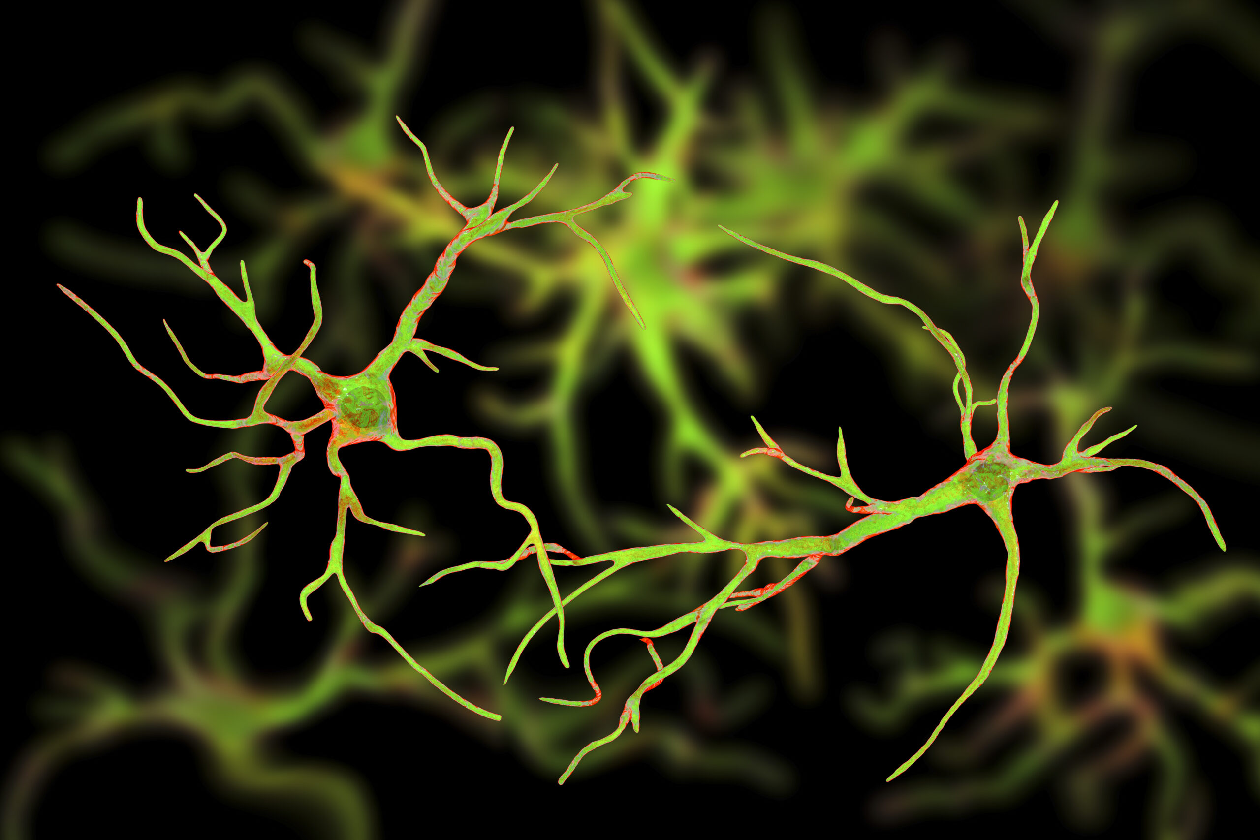 Research Reveals How Brain Inflammation May Link Alzheimer's Risk, Sleep Disturbance