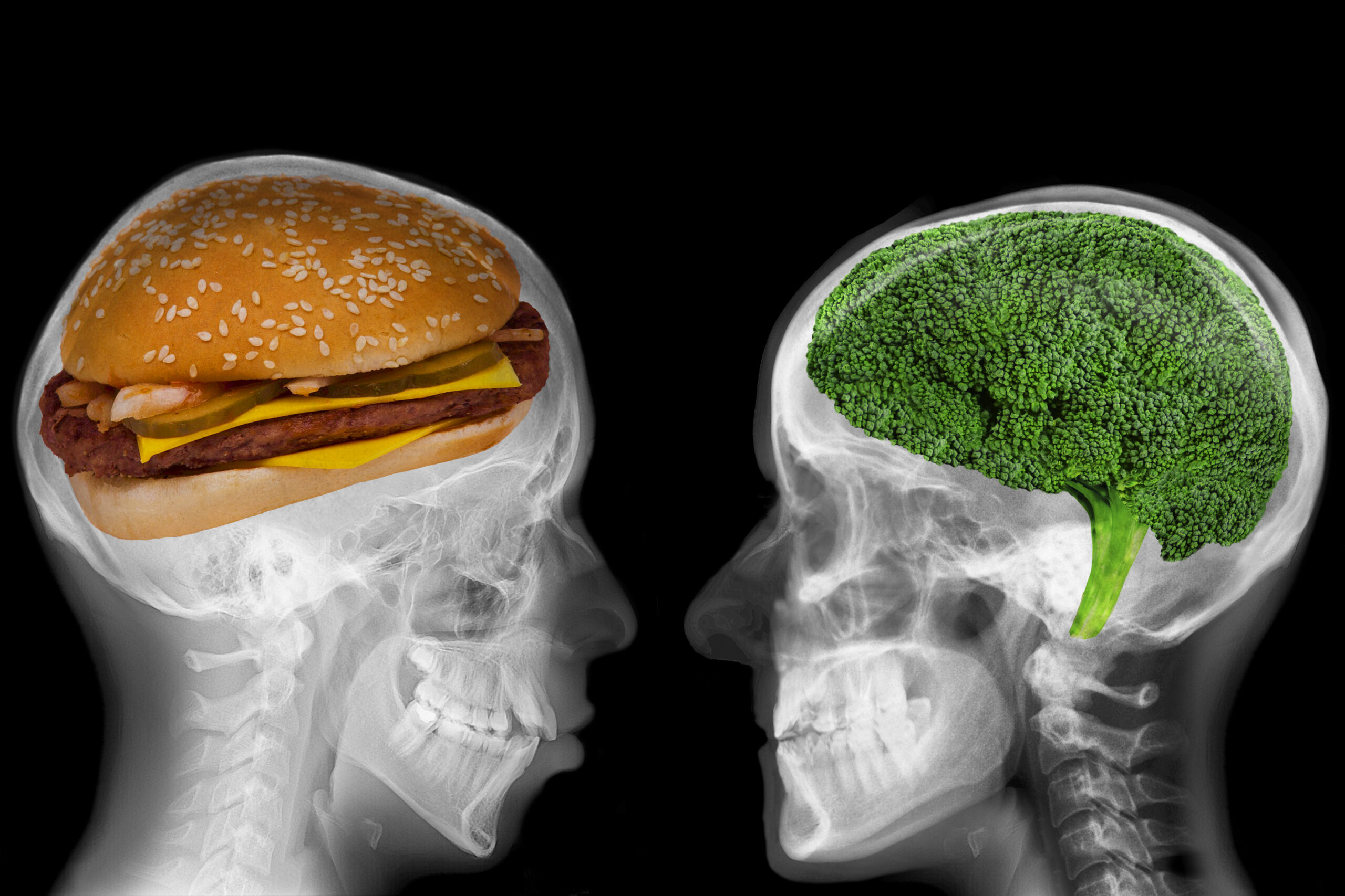 New research shows “profound” link between dietary choices and brain health