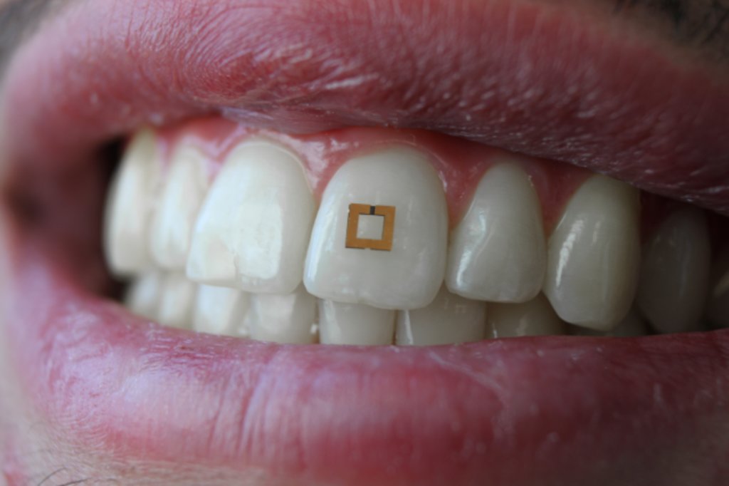 Tiny Tooth Technology