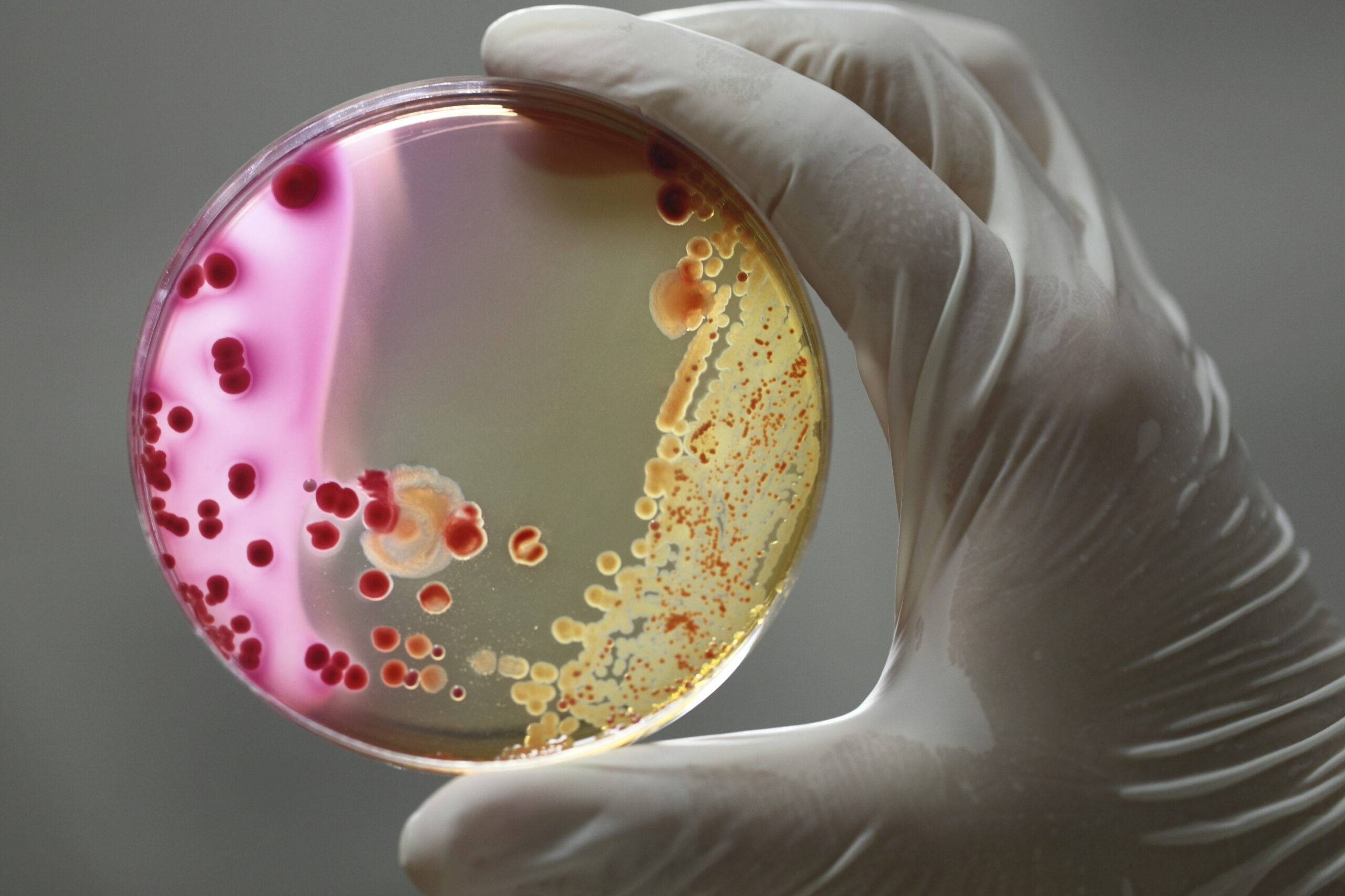 Skin Bacteria May Help To Protect Skin Against Cancer