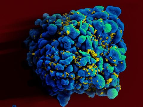 Experimental mRNA HIV Vaccine Shows Promise In Animals