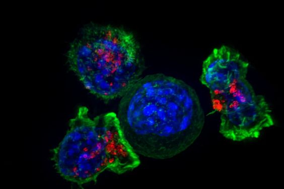 Study Identifies Receptor That Could Alleviate Need For Chemo, Radiation Pre-T Cell Therapy
