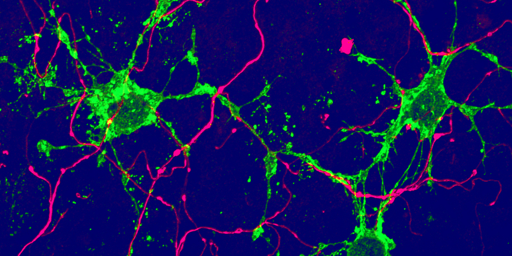 New glial cells discovered in the brain: Implications for brain repair