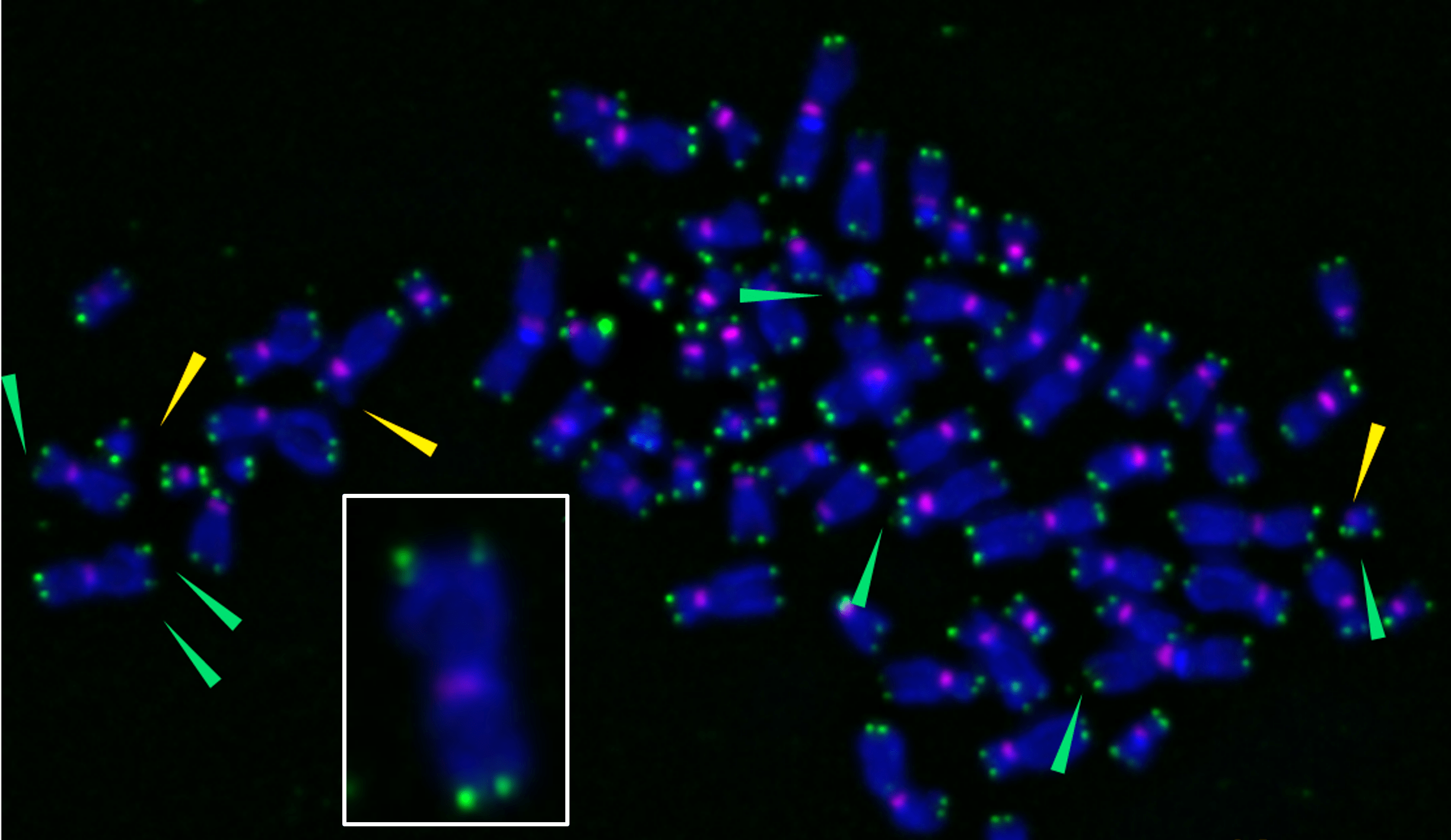 New Pathway For Accumulation Of Age-Promoting 'Zombie Cells'