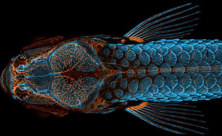 Fishing for Clues to Human Health: Tiny Zebrafish Give Big Insights