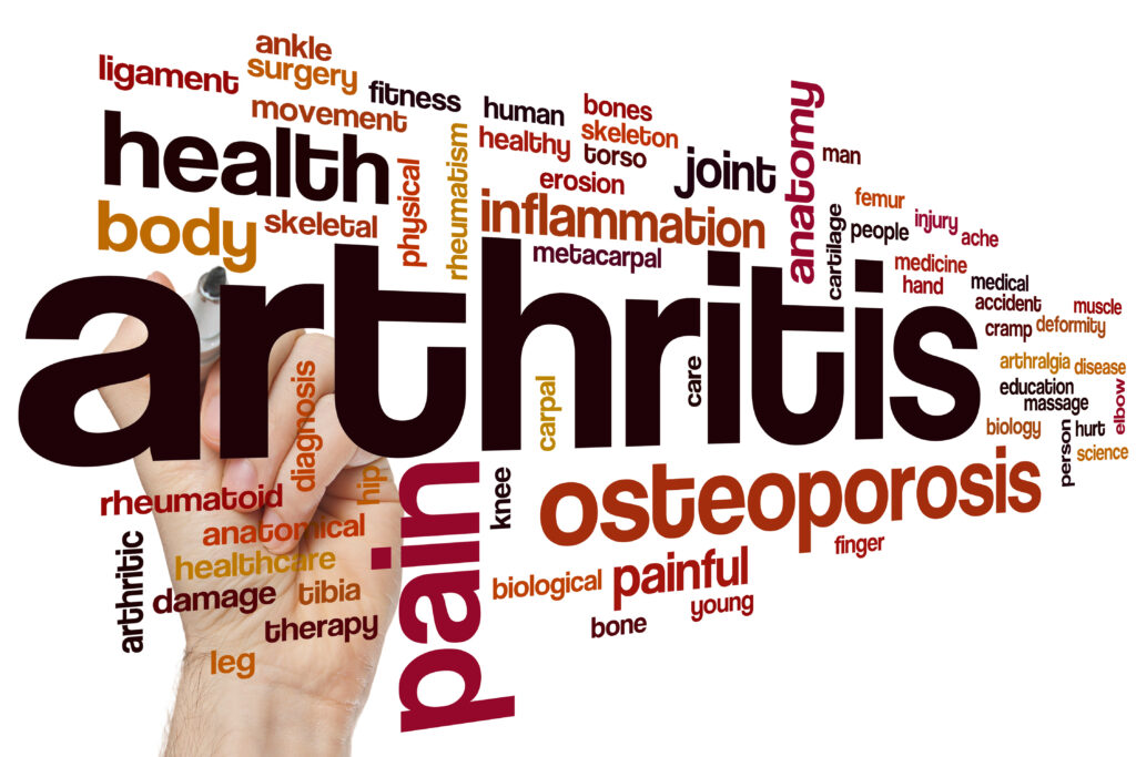 Living a Fulfilling Life with Arthritis: Practical Tips for Daily Management
